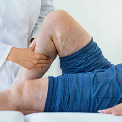 DVT Treatment in Jaipur