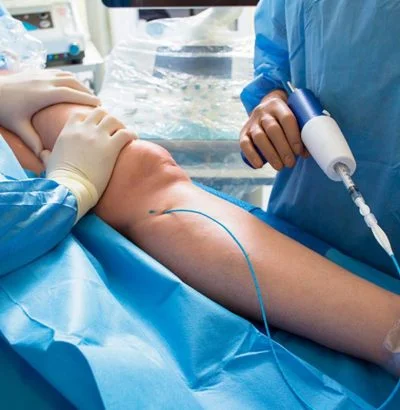 Venaseal Procedure​ in Jaipur