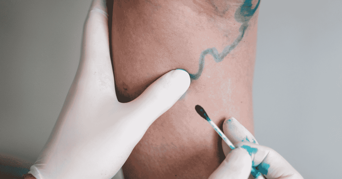 Comprehensive Vascular Evaluation