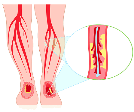 Vascular Health Diagram