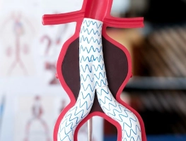 Endovascular Aneurysm Repair (EVAR/TEVAR)