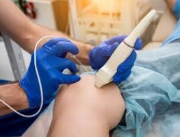 Radiofrequency Ablation (RFA)