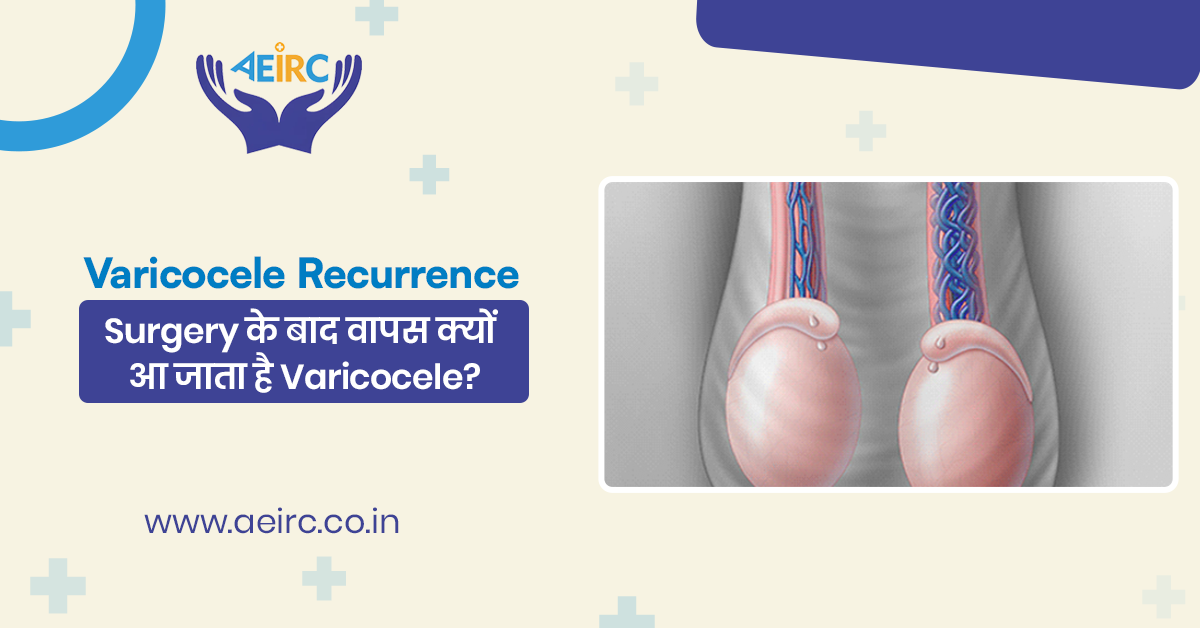 Varicocele Recurrence: Surgery के बाद वापस क्यों आ जाता है Varicocele?