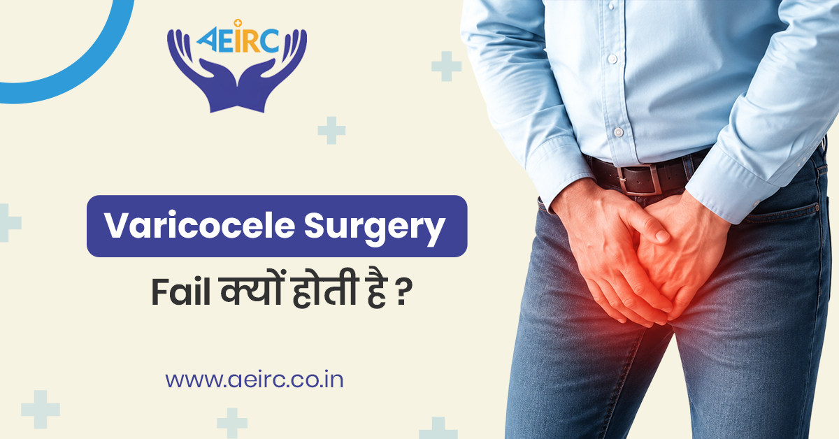 Varicocele Surgery Fail क्यों होती है? जानिए 5 कारण
