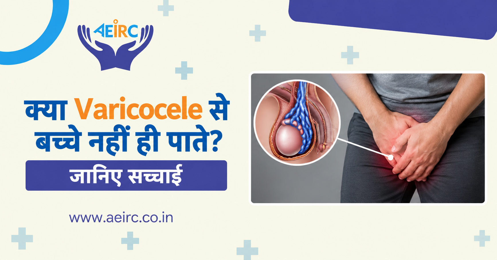 क्या Varicocele से बच्चे नहीं हो पाते? जानिए सच्चाई